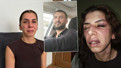 Öldüresiye dövüp tehdit etmişti! Şiddet mağduru kadından yürek yakan feryat