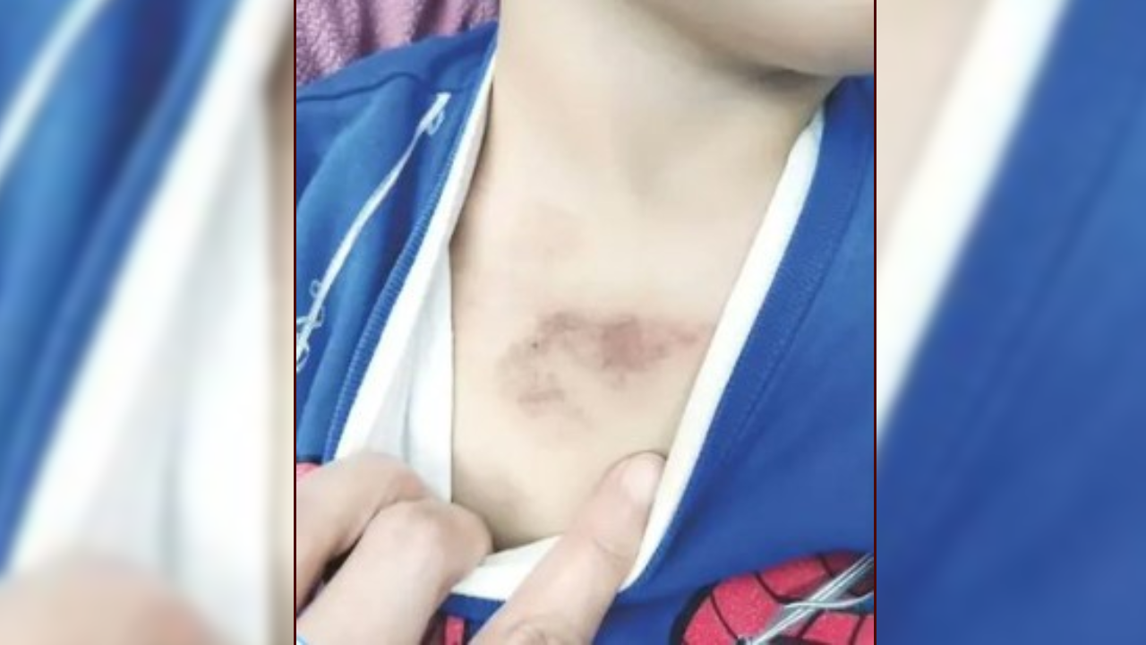 Kreşte skandal şiddet iddiası! Valilik soruşturma başlattı