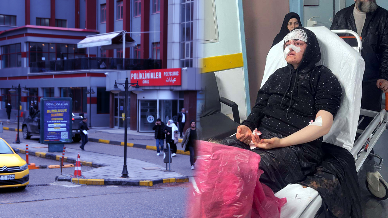 Sokak ortasında dehşet! Boşanma aşamasında eşini kaldırım taşıyla dövdü