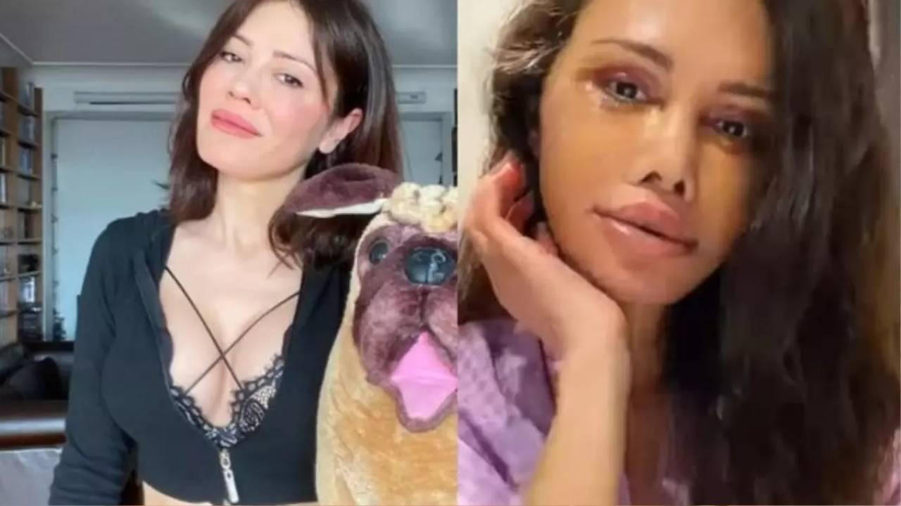 Eski Survivor yarışmacısı Didem Ceran yüz nakli yaptırdı! Son halini görenler şoke oldu