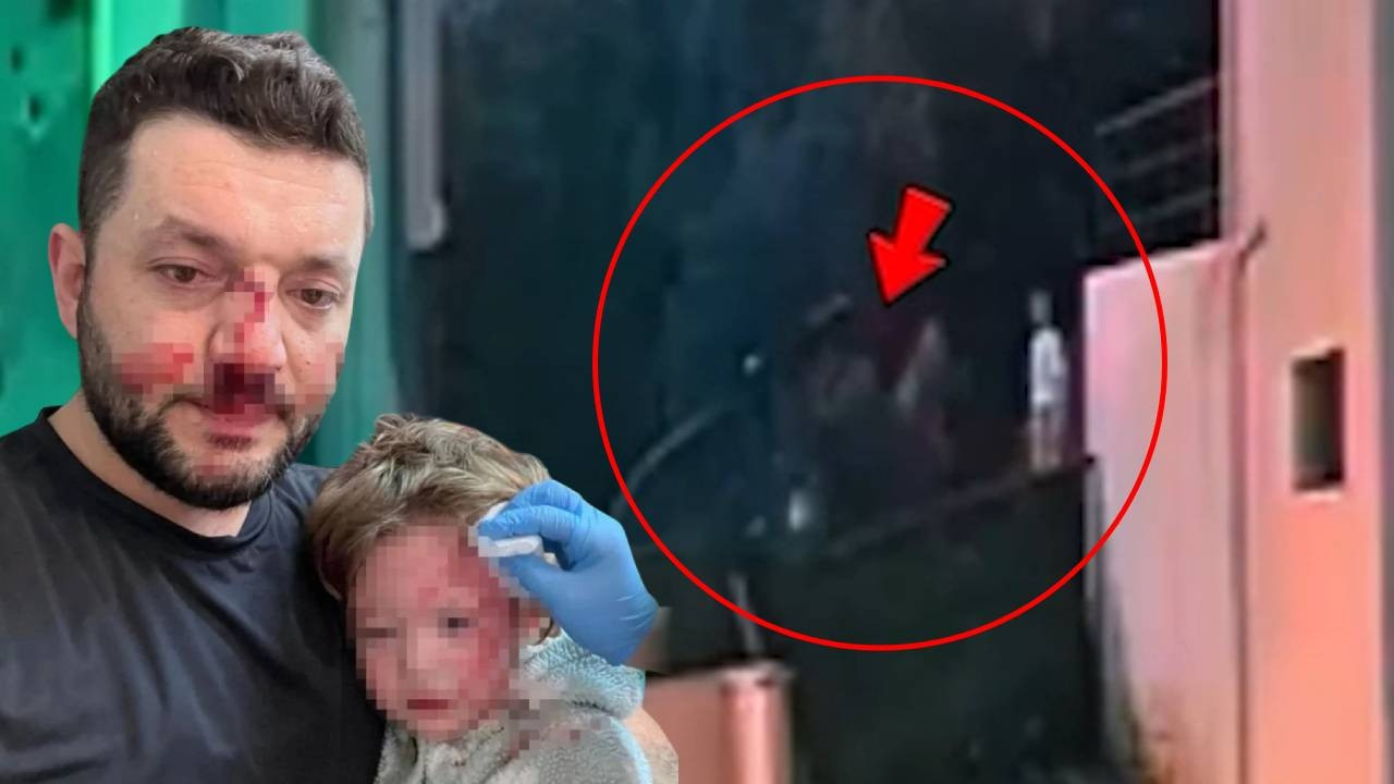 Yalova'da kan donduran şiddetin görüntüleri ortaya çıktı! Baba ve 14 aylık bebeği darp edilmişti