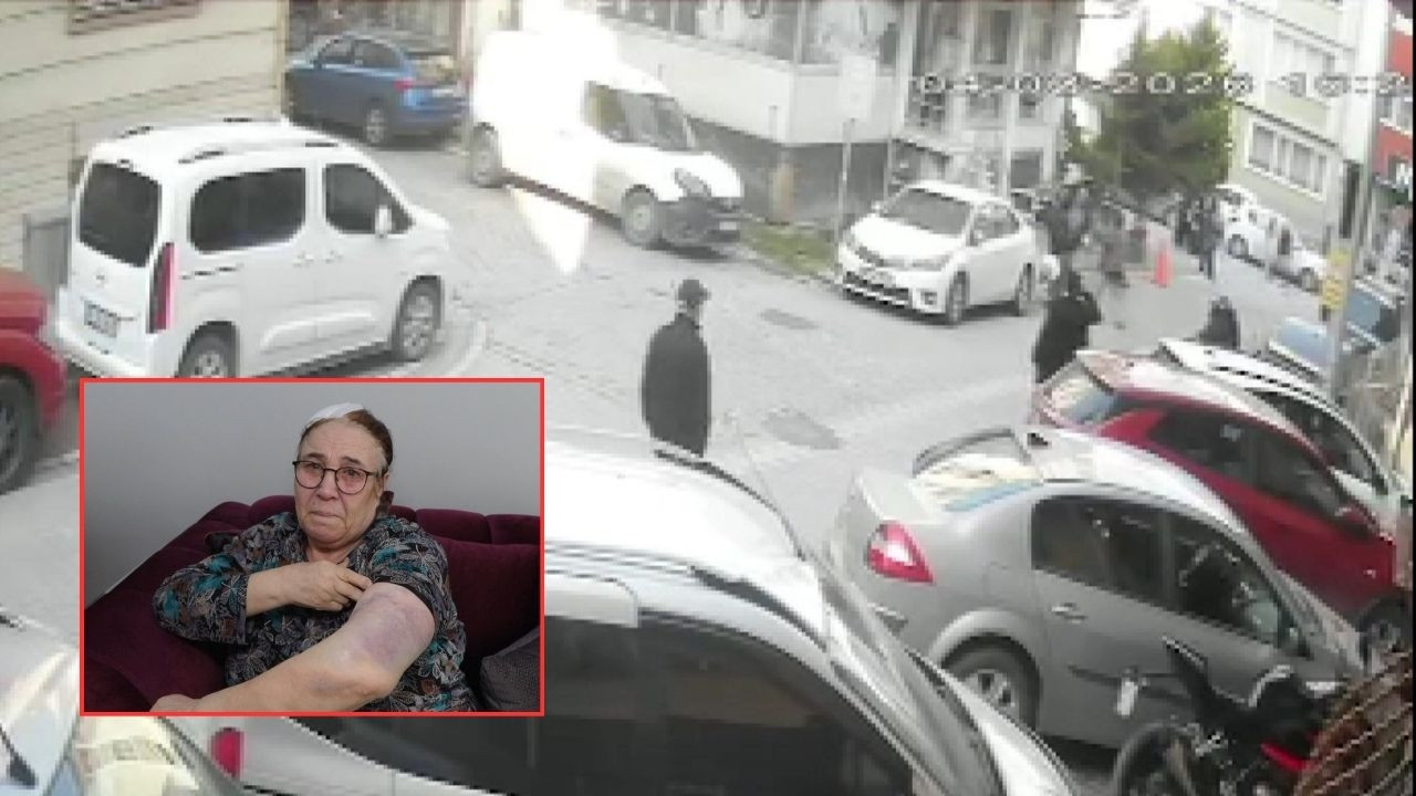 Esenyurt'ta komşu şiddeti iddiası! Sokak ortasında darbetti, 7 dikiş atıldı