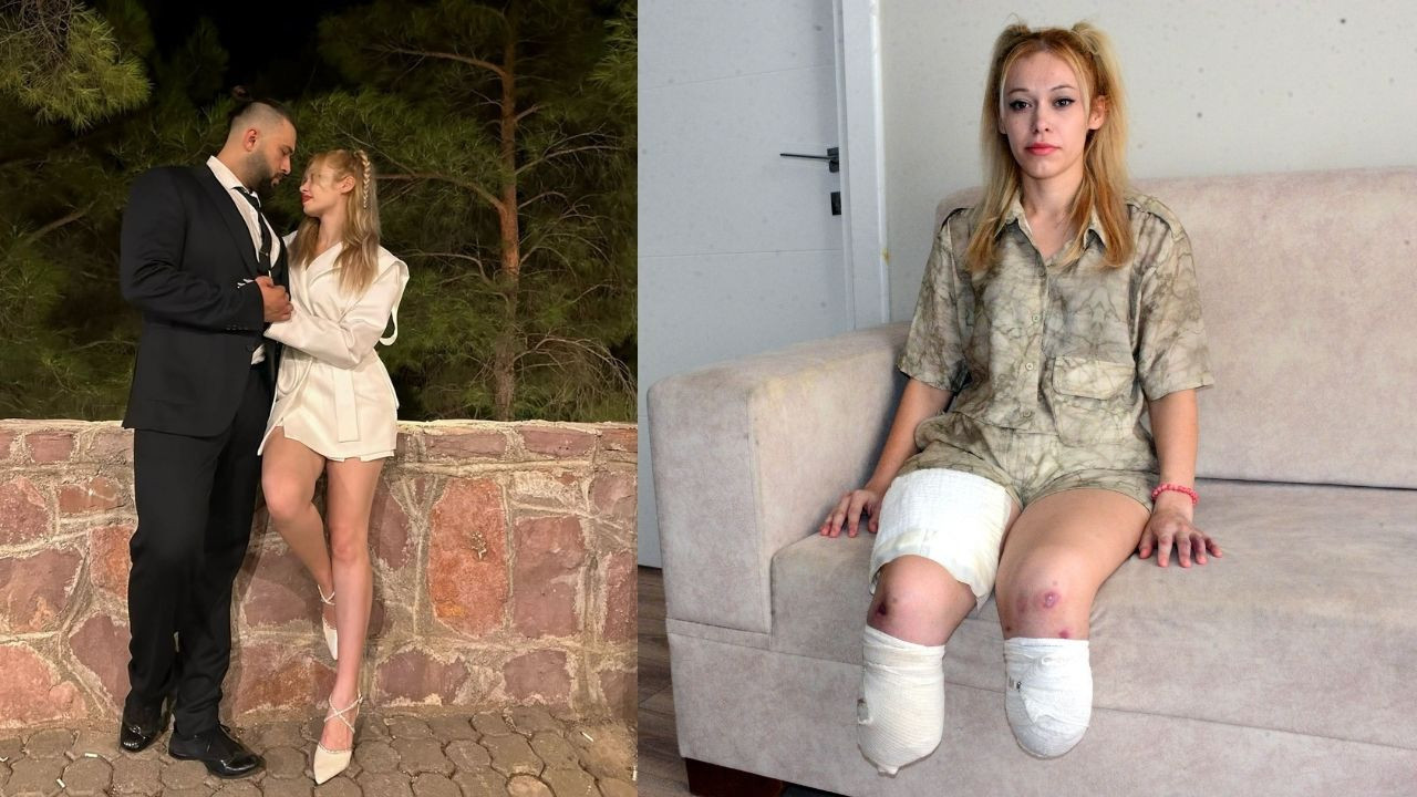 En mutlu gününde iki bacağını kaybetti! İrem, adaleti arıyor