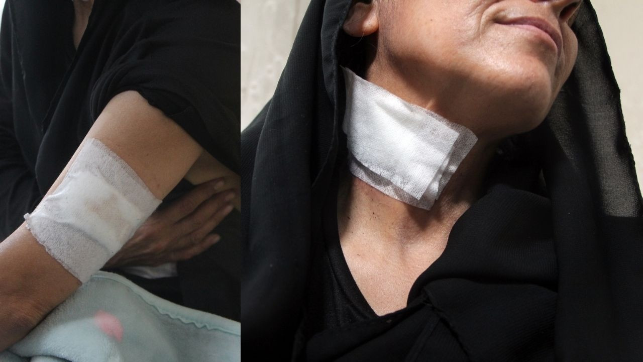 “Polisiz” diyerek eve girdiler, kurşun yağdırdılar: Anne ve oğlu ölümden döndü