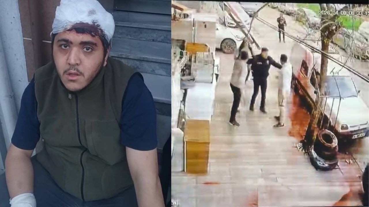 Zihinsel engelli genç ve annesine sopalı darp! Sokak ortasında dehşeti yaşadılar: "Beni istemiyorlar"