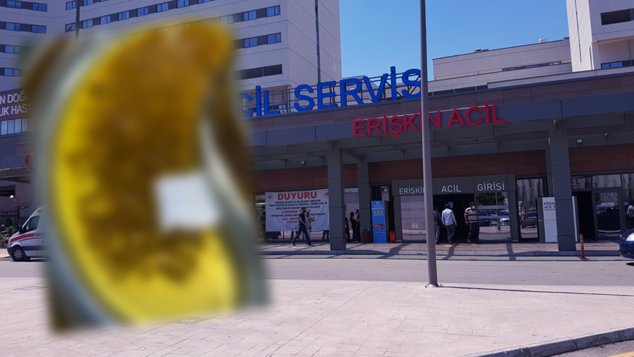 Karın ağrısı şikayetiyle gitmişti! Tam 2 bin 67 tane çıkarıldı: Doktorlar hayrete düştü