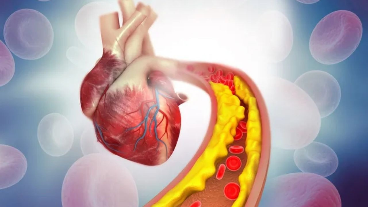 Kalp krizi artık 30 yaşa kadar indi! Uzmandan kritik uyarı: Kolesterolünüzü ölçtürün