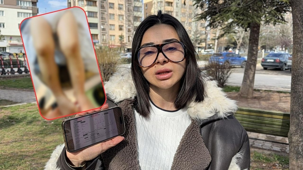 Kreşte skandal iddia! 2 yaşındaki çocuğu darbederek kovdular: Atlas okula gelmesin