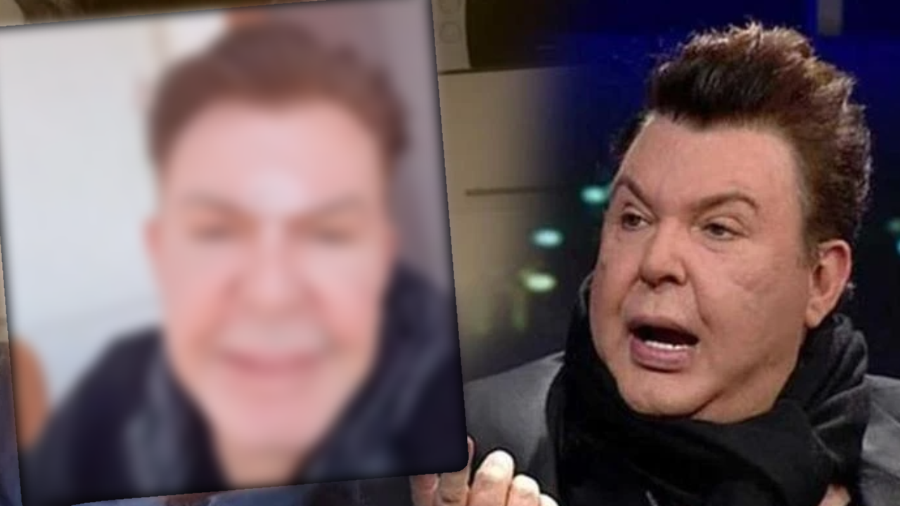 Yüz gerdirme operasyonu olmuştu! Ünlü isim son haliyle gündem oldu