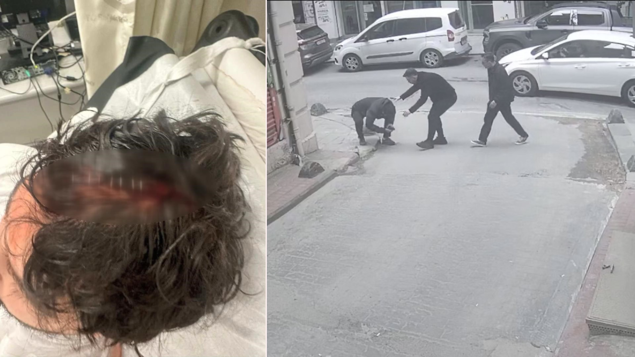 Yolda yürürken ölümden döndü! Başına tam 7 dikiş atıldı