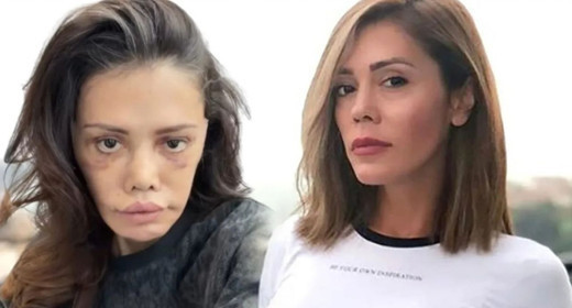 Yeniden bıçak altına yattı, doktorlara isyan etti! Didem Ceran: Dava edeceğim