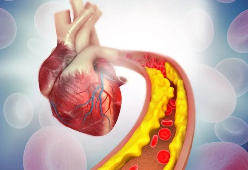 Kalp krizi artık 30 yaşa kadar indi! Uzmandan kritik uyarı: Kolesterolünüzü ölçtürün